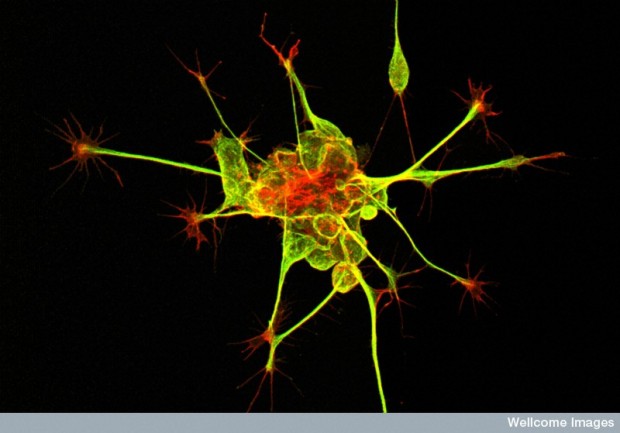 Neuron