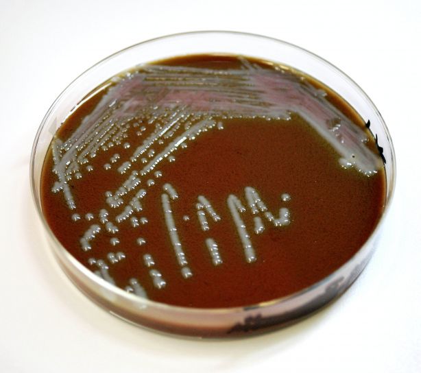 Agar Plate
